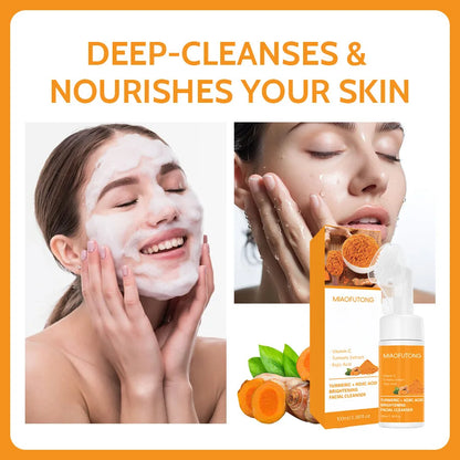 Transform Your Skin with Our Turmeric Cleanser & Soap Set - Powerful Kojic Acid Formula for Blackhead Elimination, Oil Control, and Acne Scar Reduction!